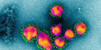 Pandemia já fez 422 doentes no distrito de Setúbal