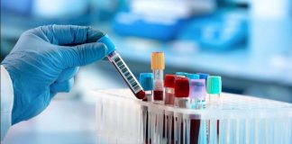 Lares de idosos do distrito de Évora já estão a ser testados