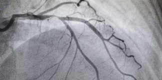 Hospital de Évora realiza a primeira coronariografia não invasiva no sul do país