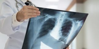 AMI vai recolher radiografias antigas em Setúbal